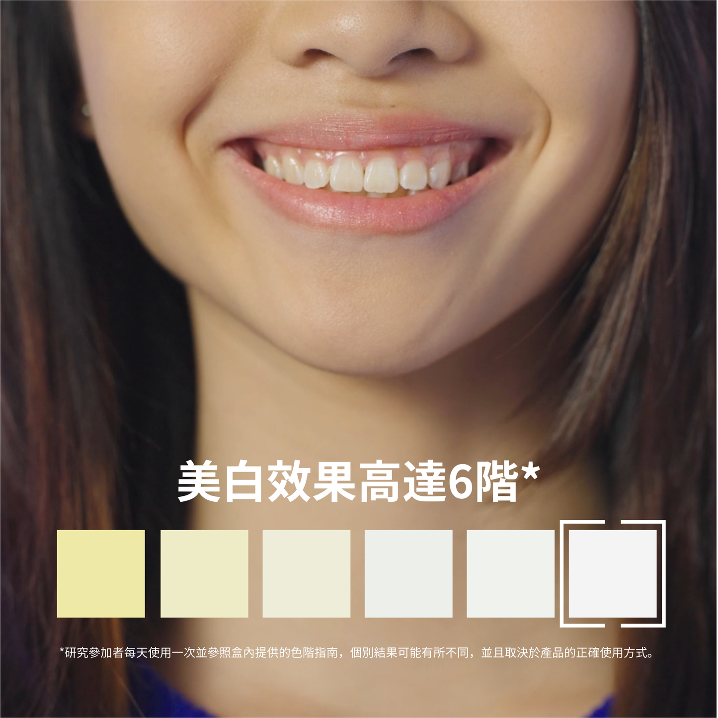 ZenyumBright™ Pro 專業亮白美齒筆(2支)