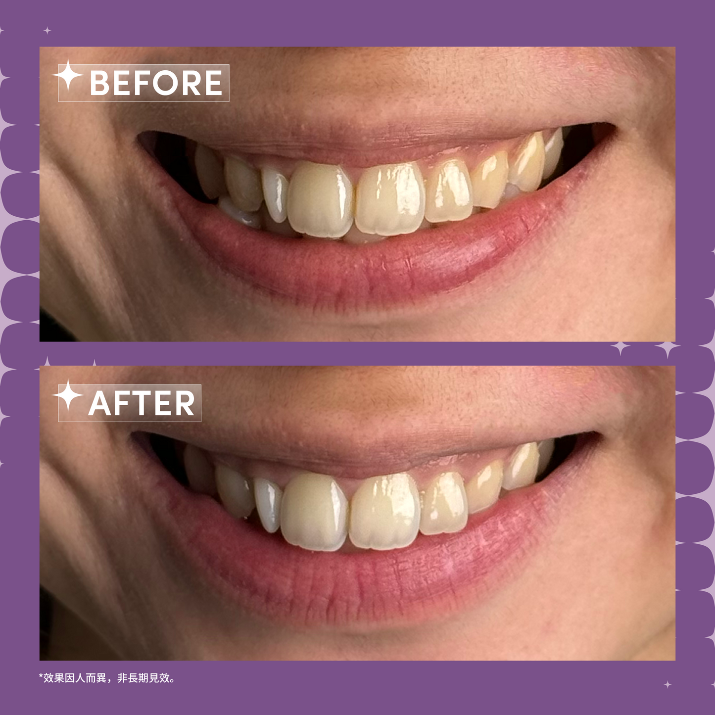 ZenyumBright™ Whitening Smile Group