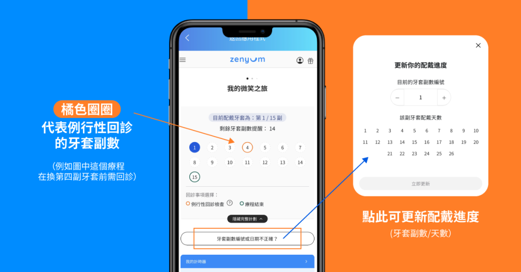 Zenyum App 官方介面：我的微笑之旅及牙套療程進度